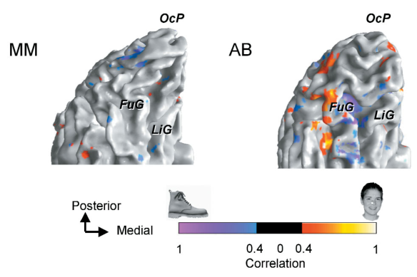 Fig3