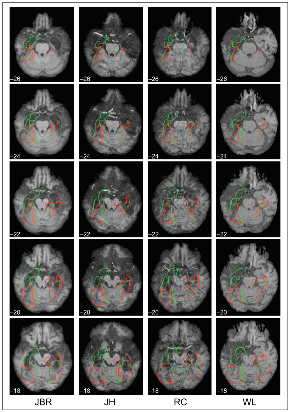 Fig3