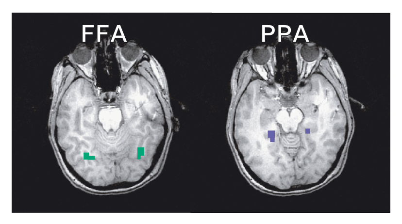 Fig2