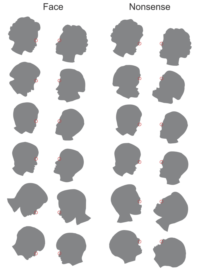 Fig2