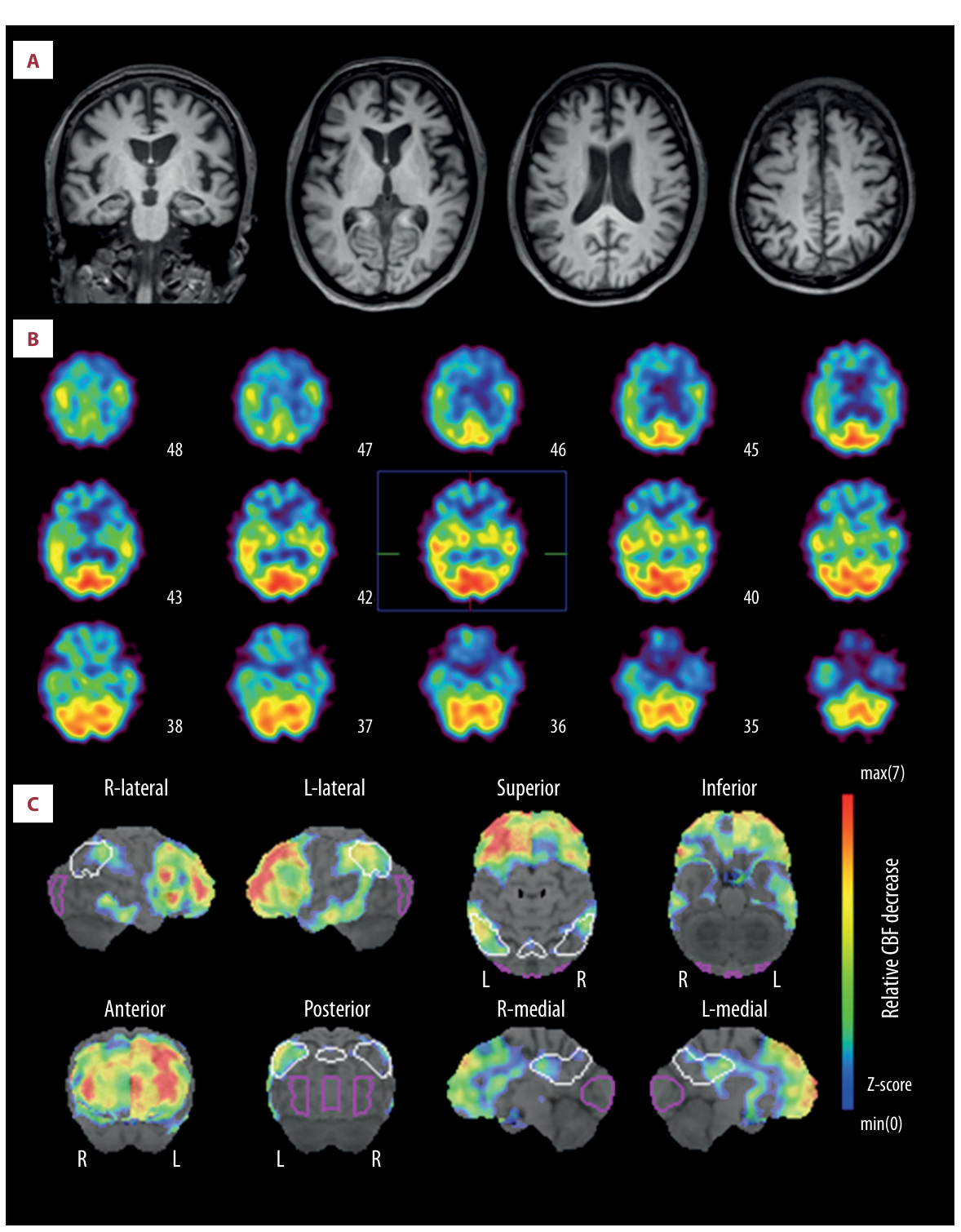 Fig1