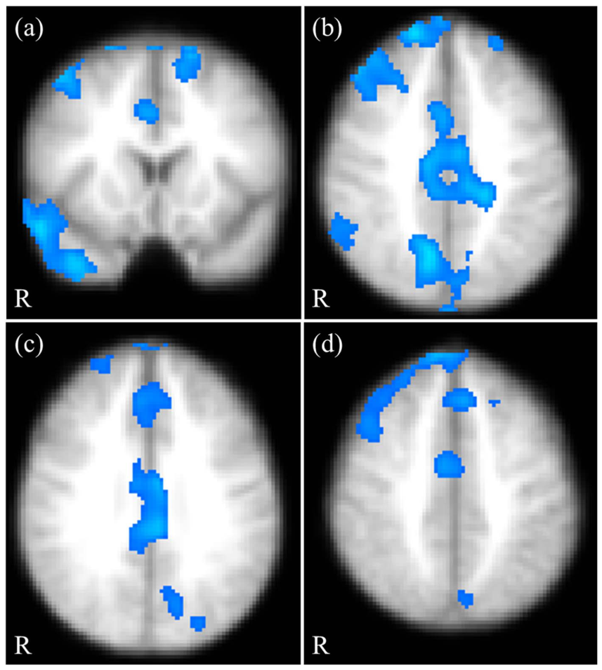 Fig1