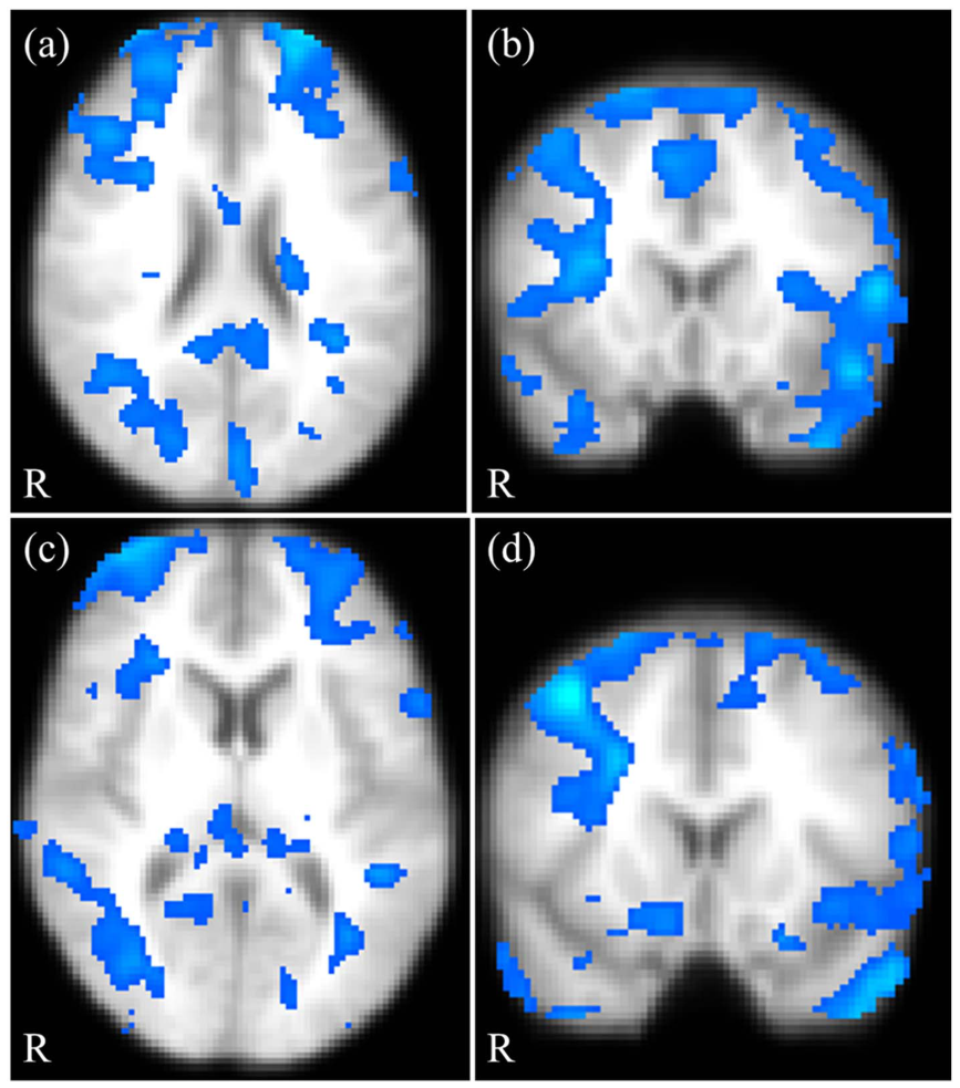 Fig2