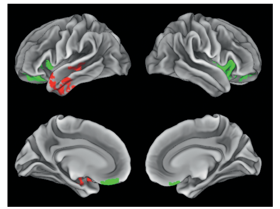 Figure 15