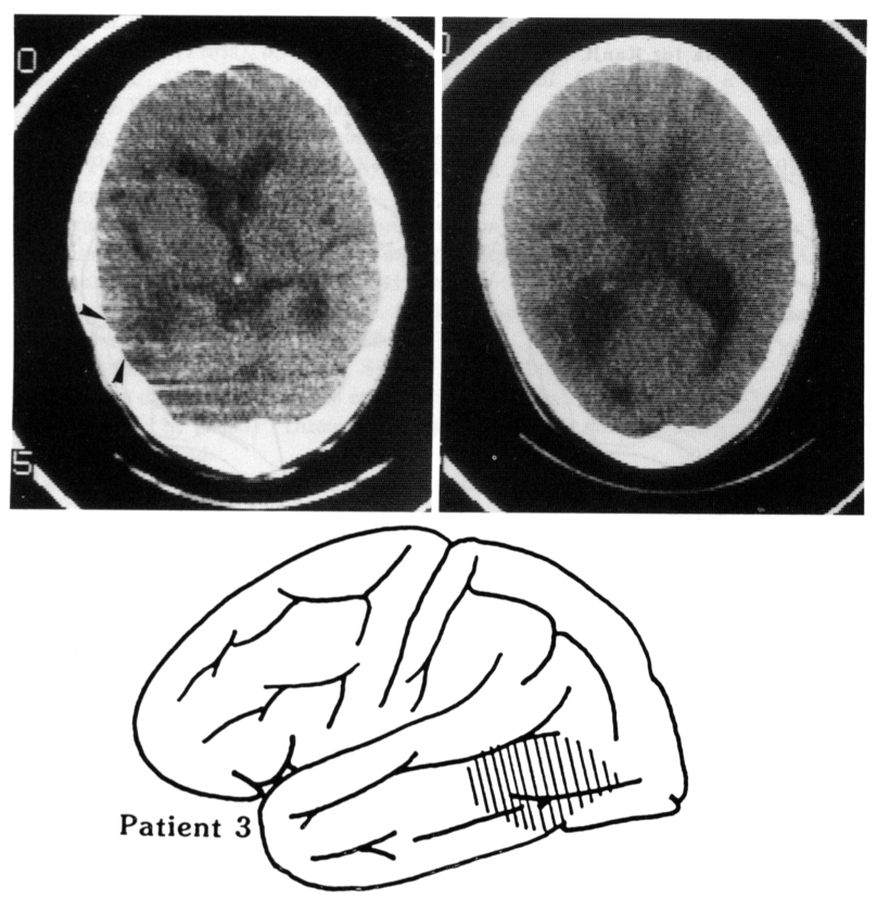 Figure 21